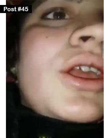 Post 45